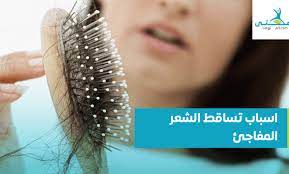 اسباب تساقط الشعر المفاجئ وطرق علاجه Sudden Hair Loss Hair Care Hair Loss