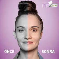 Earlap Bantlari Ile Kepce Kulak Sorununa Ameliyatsiz Cozum Ile Tanis Kullanimi Cok Kolay Ve Pratik Ustelik Seffaf Yuzeyi Sayesind Bant Guzellik Sac Maskeleri