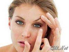 Goz Kapagi Dusuklugu Sifali Bitkilerle Bakim Cilt Bakimi Gozler Dusuk Gozler