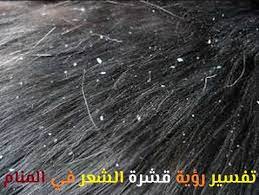 تفسير رؤية قشرة الشعر في المنام لابن سيرين موقع مصري Movie Posters Movies