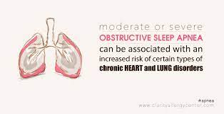 Learn The Signs Of Obstructive Sleep Apnea These Are Common Signs And Symptoms Seen With Obstructive What Causes Sleep Apnea Sleep Apnea Symptoms Sleep Apnea