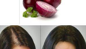 كاع لي كتعاني من تساقط الشعر والفراغات فالقدام تدخل بالزربة وصفة طبيعية دقة بطلة Fashion