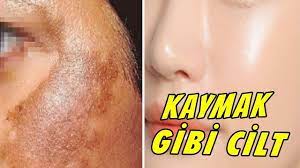 Kaymak Gibi Lekesiz Cilt Icin Yogurt Maskesi Gunes Lekesi Dogum Lekele Cil Maskeler Guzellik
