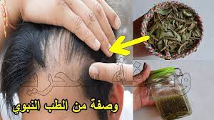مذكور في القرآن لعلاج تساقط الشعر ت نب ت وتملأ الفراغات من الامام للرجال والنساء من الطب النبوي Hair Care Oils Beauty Recipes Hair Beauty Skin Care Routine