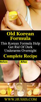Old Korean Formula This Korean Formula Help Get Rid Of Dark Underarms Overnight Complete Recipe Dark Underarms Dark Armpits Skin Care Tips