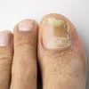 Deja que estos luzcan delicados y suaves con esta decoración de uñas para los pies. Https Encrypted Tbn0 Gstatic Com Images Q Tbn And9gcr9xkrhdd Qnfbsmas5ld7xutzrjqsx9hhbxf6k6dhhq5no Ckuqfgfawf Cmfehpezp5eujbdvzihzp7ot1w Usqp Cau Ec 45794965