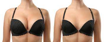 Should I Consider a Breast Lift During My Breast Augmentation Surgery? -  Dr. William Adams