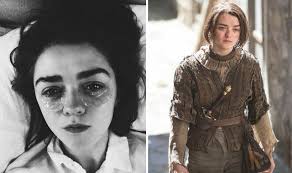 Game of Thrones' Maisie Williams has been wearing blind contacts to film  sixth season | TV & Radio | Showbiz & TV | Express.co.uk