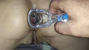 Medical Anal Speculum Porn Videos @ 🍆✊️💦 Letmejerk.net