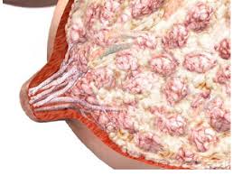 The lactating breast (Medela AG, Switzerland 2006) | Download Scientific  Diagram