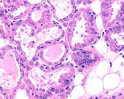 Lactating Breast Tissue Photograph by Jose Calvo/science Photo Library -  Pixels
