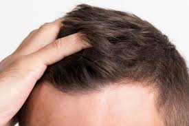 Top 16 Best Hair Growth Supplements: Most Effective Hair Regrowth Vitamins - Sponsored Content | The Times of Israel