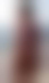 Nacktsonnen