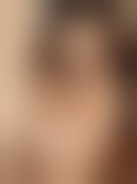 TheFappening