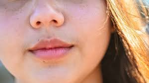 Hirsutismus: Ursachen, Anzeichen, Therapie | gesund.bund.de