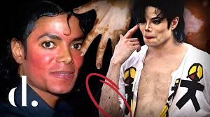 A DEEP Analysis of Michael Jackson’s Changing Skin Tone! | the detail.
