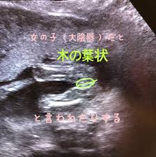 エコー写真‥‥女の子？！ | 助産師さき先生の愛着育児♡ ママとこどもの心がハッピーになる育て方✨