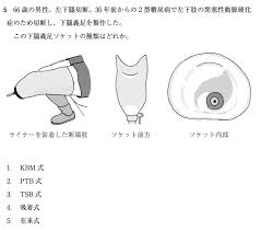 フィジスタ