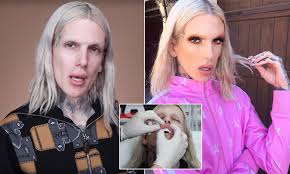 Jeffree Star reveals a doctor secretly injected his lips with silicone
