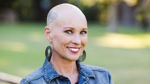 We Need to Talk About Female Hair Loss