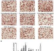 e Effects of rosiglitazone, curculigoside and EAF on ...