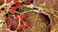 This common infection is actually an STI