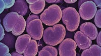 CDC’s top laboratory on sexually transmitted diseases is shut by Trump administration