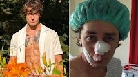 Heroic US Model Stabbed In Germany, Slams Europe's Immigration Problem