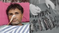 Surgeons remove 29 spoons, 19 toothbrushes, pens from patient’s stomach