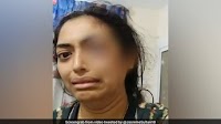 Indian Arrested In Sharjah After Video SOS Of Wife, Bleeding From Eye