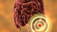 Targeted Therapy Wins Big for BRAF -Mutated Metastatic CRC