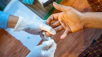 Sexually Transmitted Diseases Killing 2.5 Million People Every Year Globally: UN