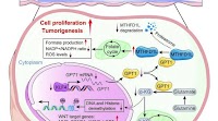 Low levels of a single enzyme influence pathway to malignancy in colorectal cancer, scientists find