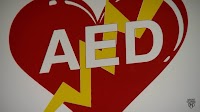 Automated external defibrillators: How to use an AED