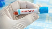 Monkeypox: Transmission, and Prevention