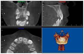 cone beam computed tomography