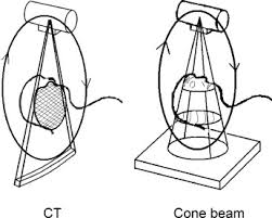 cone beam imaging s in ent