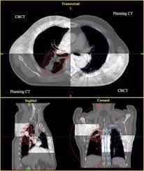 cone beam computed tomography and image