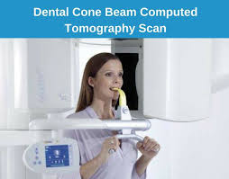 cone beam ct dental scan glendale