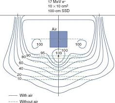 electron beam therapy dosimetry