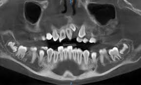 cone beam en orthopé dento e