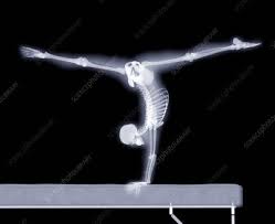 gymnast on a beam x ray artwork