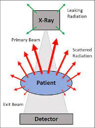 intraoperative fluoroscopy