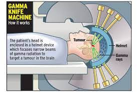 gamma knife for avm or brain tumor