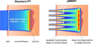 technical aspects of proton minibeam