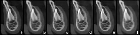 paediatric cone beam ct