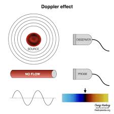 Doppler Shift Radiology Reference