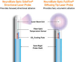 fiber optic laser on 50 off