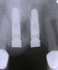 cone beam computed tomography in dental