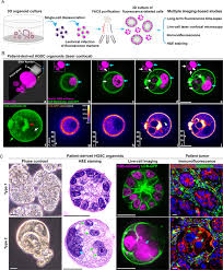 Polyploid Giant Cancer Cells